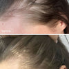 Hair Growth Serum - 30ml - UKLASH